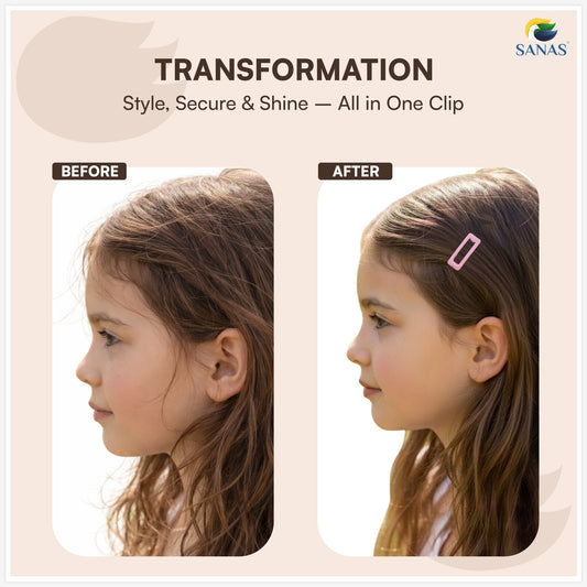 Sanas (36Pcs) Small Tic Tac Hair Clips For Women Stylish Trendy Tic Tac Clip For Girls Hair Accessories For Kids Girls Return Gifts Baby Hair Clips For Girls Baby Clips For Kids (Mixed Colors) (36Pcs)