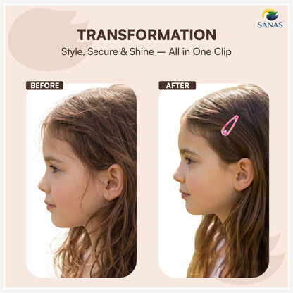 Polka dot tic tac clips for everyday hairstyles