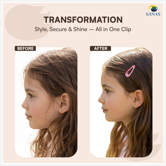 Sanas (24Pcs) Small Tic Tac Hair Clips For Women Stylish Polka Dot Tic Tac Clip For Girls Hair Accessories For Kids Girls Return Gifts Baby Hair Clips For Girls Baby Clips For Kids (Multicolor) (24Pcs)